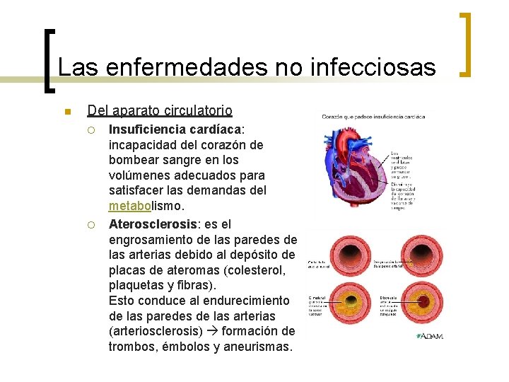 Las enfermedades no infecciosas n Del aparato circulatorio ¡ ¡ Insuficiencia cardíaca: incapacidad del