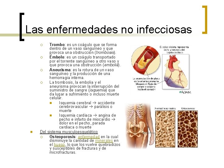 Las enfermedades no infecciosas Trombo: es un coágulo que se forma dentro de un