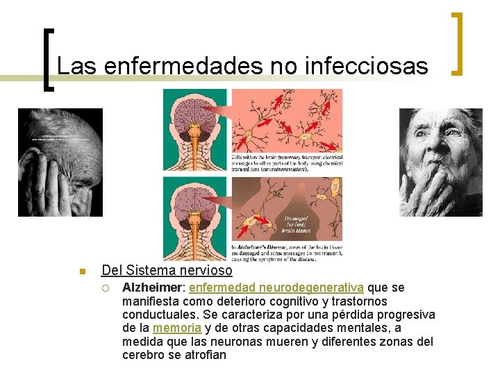 Las enfermedades no infecciosas n Del Sistema nervioso ¡ Alzheimer: enfermedad neurodegenerativa que se