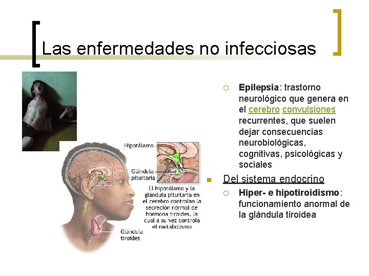 Las enfermedades no infecciosas ¡ n Epilepsia: trastorno neurológico que genera en el cerebro