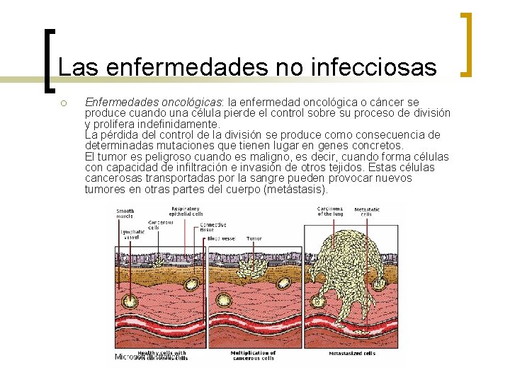 Las enfermedades no infecciosas ¡ Enfermedades oncológicas: la enfermedad oncológica o cáncer se produce