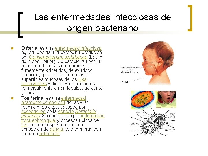 Las enfermedades infecciosas de origen bacteriano n n Difteria: es una enfermedad infecciosa aguda,