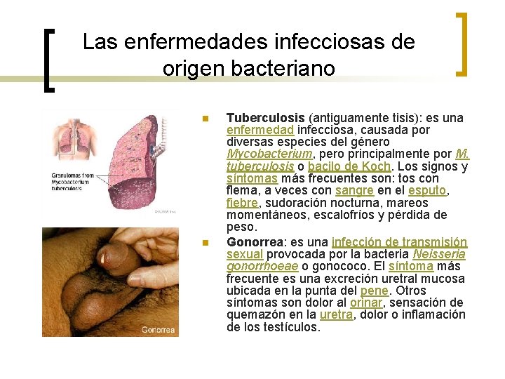 Las enfermedades infecciosas de origen bacteriano n n Tuberculosis (antiguamente tisis): es una enfermedad