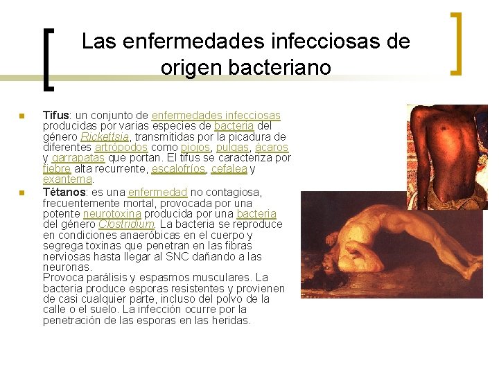 Las enfermedades infecciosas de origen bacteriano n n Tifus: un conjunto de enfermedades infecciosas