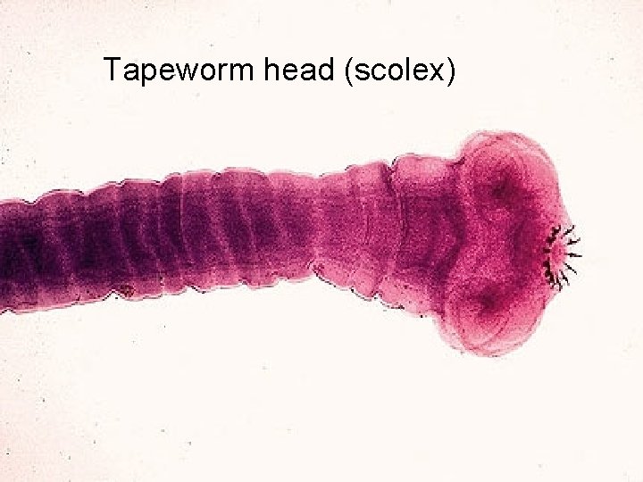 Tapeworm head (scolex) 