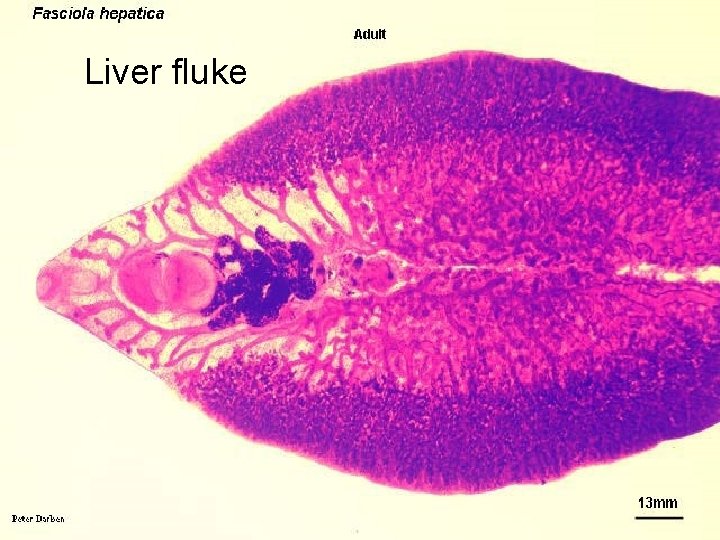 Liver fluke 