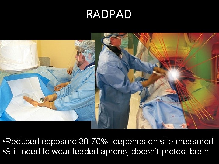 RADPAD • Reduced exposure 30 -70%, depends on site measured • Still need to