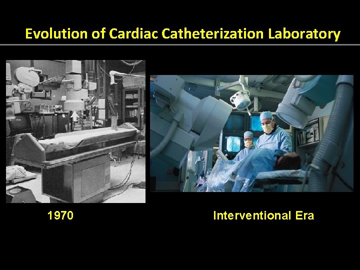 Evolution of Cardiac Catheterization Laboratory 1970 Interventional Era 
