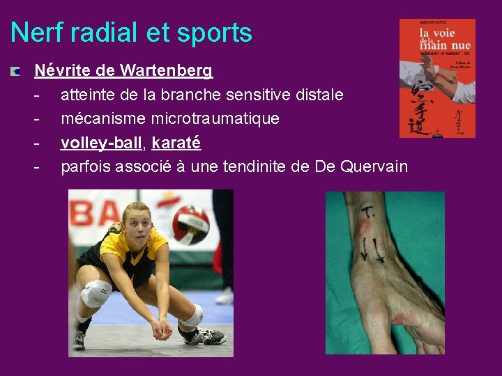 Nerf radial et sports Névrite de Wartenberg - atteinte de la branche sensitive distale