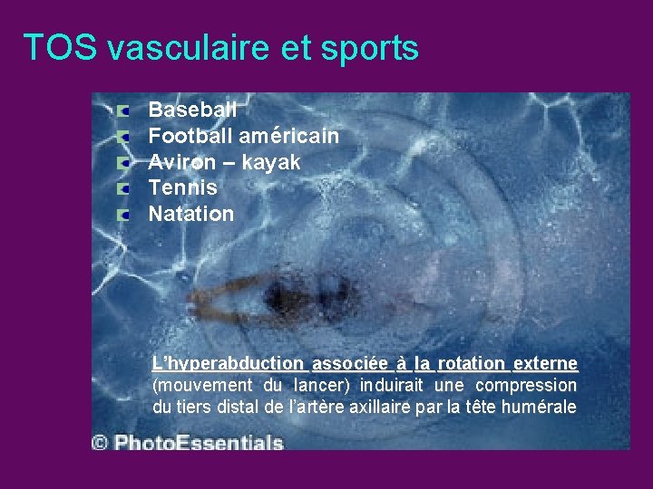 TOS vasculaire et sports Baseball Football américain Aviron – kayak Tennis Natation L’hyperabduction associée