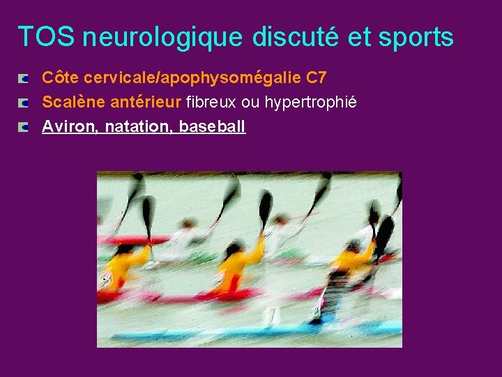 TOS neurologique discuté et sports Côte cervicale/apophysomégalie C 7 Scalène antérieur fibreux ou hypertrophié