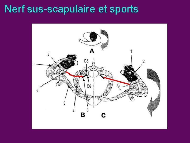 Nerf sus-scapulaire et sports 