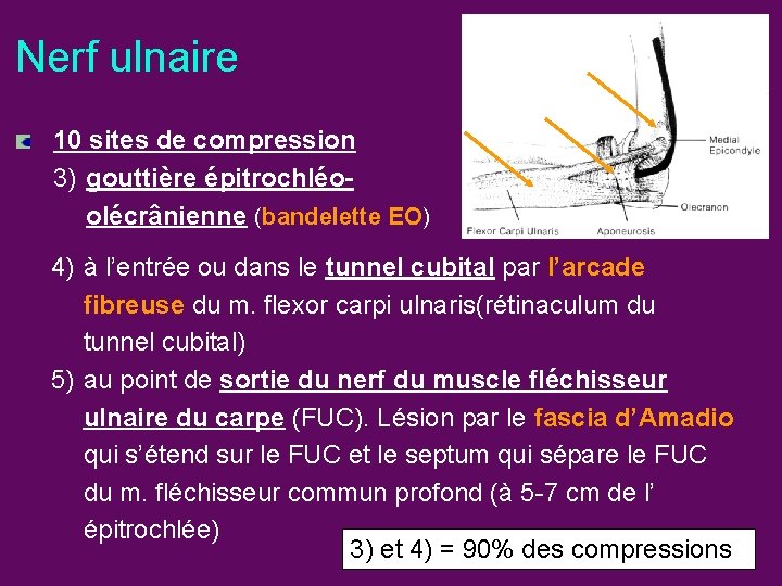 Nerf ulnaire 10 sites de compression 3) gouttière épitrochléoolécrânienne (bandelette EO) 4) à l’entrée