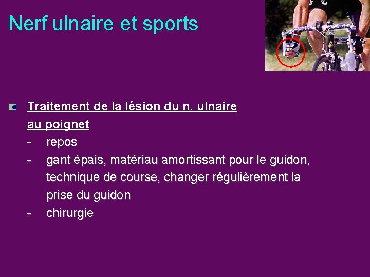 Nerf ulnaire et sports Traitement de la lésion du n. ulnaire au poignet -