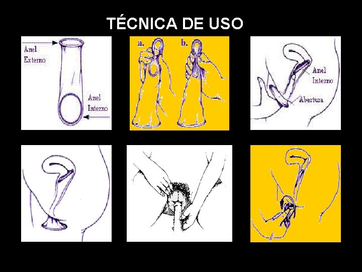 TÉCNICA DE USO 