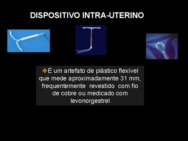 DISPOSITIVO INTRA-UTERINO É um artefato de plástico flexível que mede aproximadamente 31 mm, frequentemente