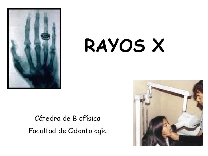 RAYOS X Cátedra de Biofísica Facultad de Odontología 