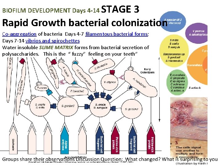 STAGE 3 Rapid Growth bacterial colonization BIOFILM DEVELOPMENT Days 4 -14 Co-aggregation of bacteria