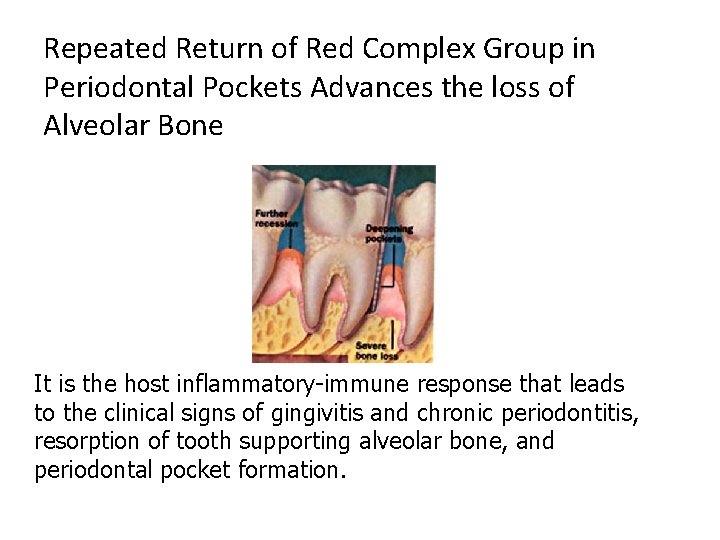 Repeated Return of Red Complex Group in Periodontal Pockets Advances the loss of Alveolar