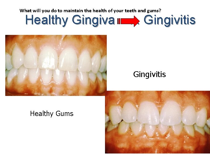 What will you do to maintain the health of your teeth and gums? Healthy