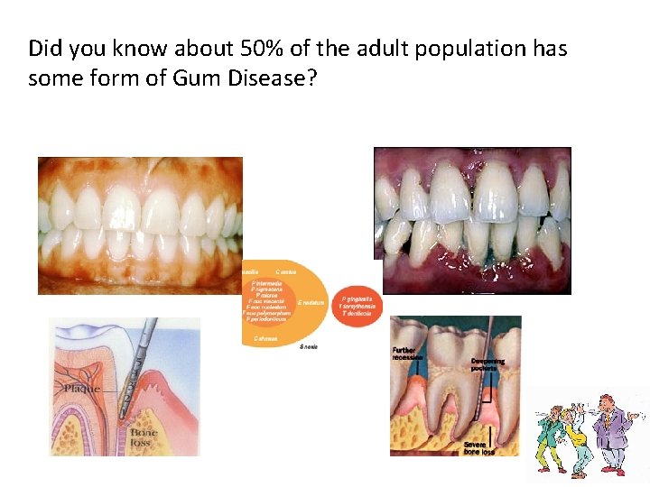 Did you know about 50% of the adult population has some form of Gum