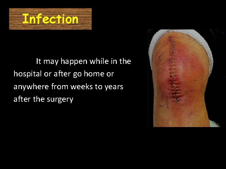 Infection It may happen while in the hospital or after go home or anywhere