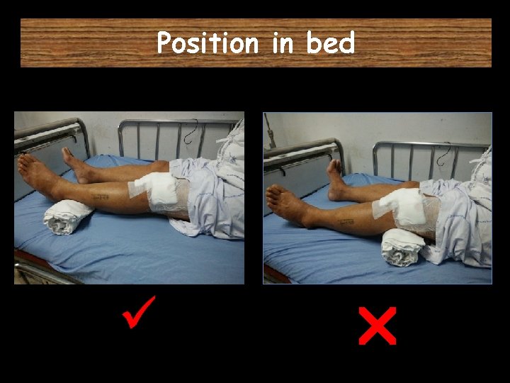 Position in bed 