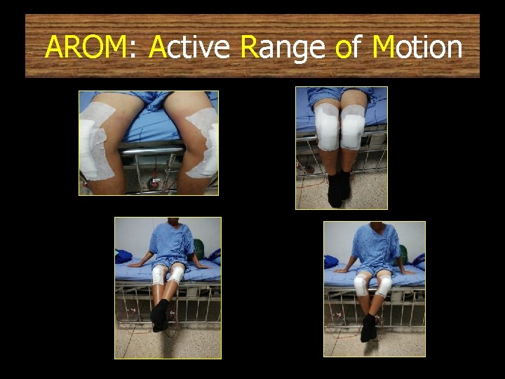 AROM: Active Range of Motion 