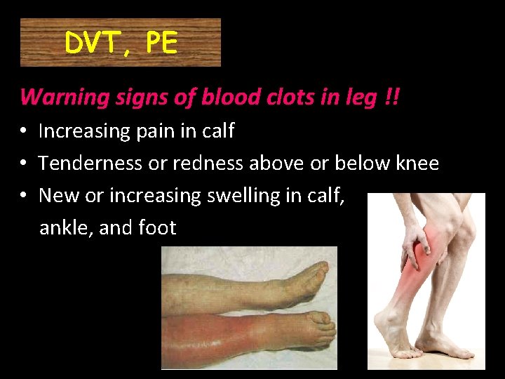 DVT, PE Warning signs of blood clots in leg !! • Increasing pain in