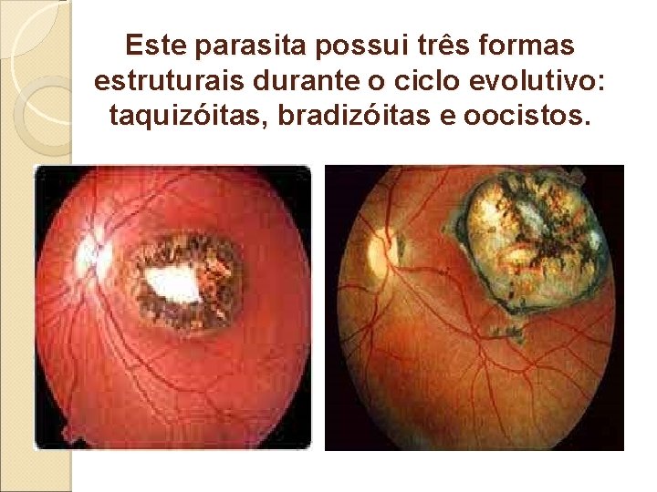 Este parasita possui três formas estruturais durante o ciclo evolutivo: taquizóitas, bradizóitas e oocistos. Este parasita possui três formas estruturais durante o ciclo evolutivo: taquizóitas, bradizóitas e oocistos.