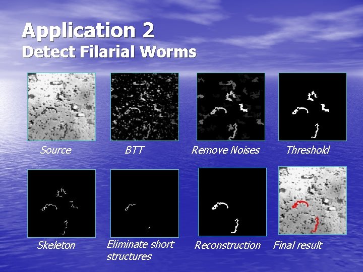 Application 2 Detect Filarial Worms Source Skeleton BTT Eliminate short structures Remove Noises Reconstruction