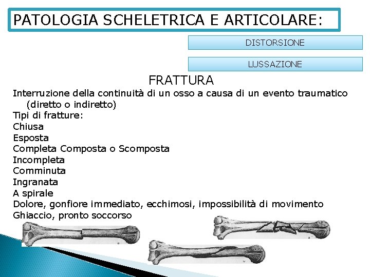 PATOLOGIA SCHELETRICA E ARTICOLARE: DISTORSIONE LUSSAZIONE FRATTURA Interruzione della continuità di un osso a