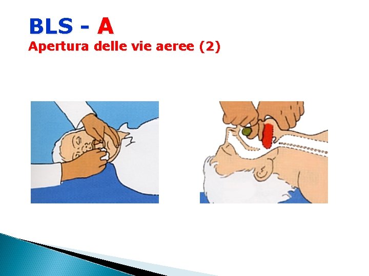 BLS - A Apertura delle vie aeree (2) 