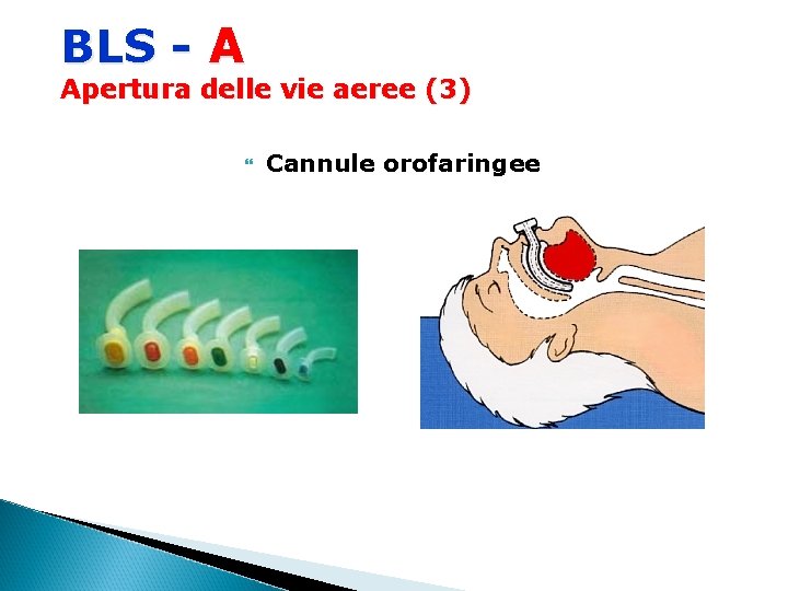 BLS - A Apertura delle vie aeree (3) Cannule orofaringee 