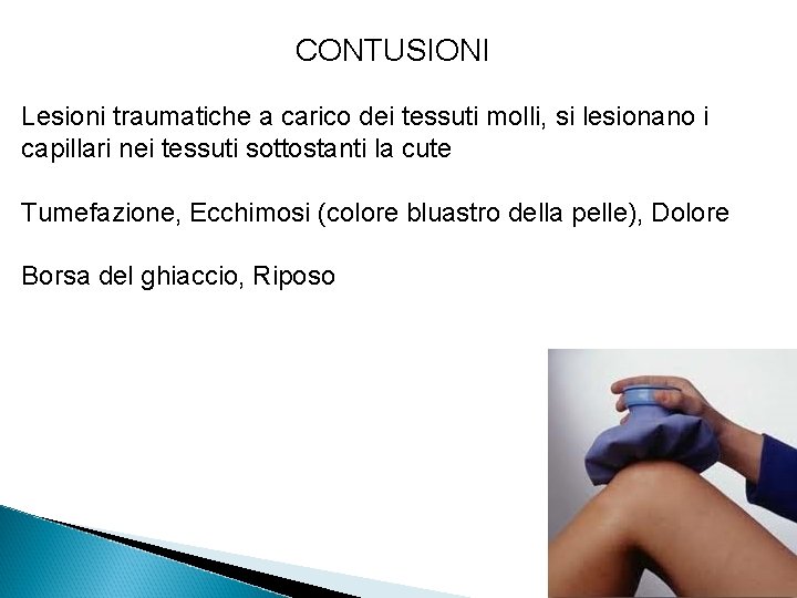 CONTUSIONI Lesioni traumatiche a carico dei tessuti molli, si lesionano i capillari nei tessuti