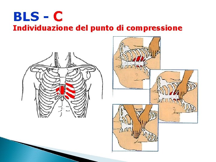 BLS - C Individuazione del punto di compressione 