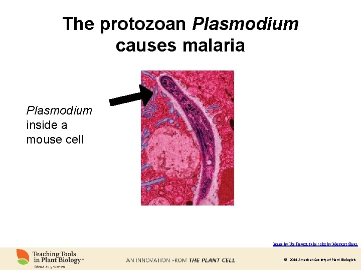 The protozoan Plasmodium causes malaria Plasmodium inside a mouse cell Image by Ute Frevert;