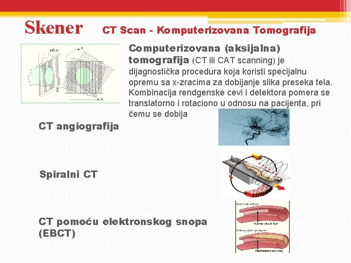Skener CT Scan - Komputerizovana Tomografija Computerizovana (aksijalna) tomografija (CT ili CAT scanning) je