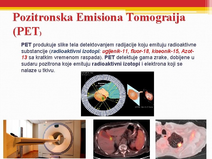 Pozitronska Emisiona Tomograija (PET) PET produkuje slike tela detektovanjem radijacije koju emituju radioaktivne substancije