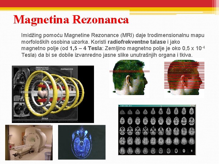Magnetina Rezonanca Imidžing pomoću Magnetine Rezonance (MRI) daje trodimensionalnu mapu morfoloških osobina uzorka. Koristi