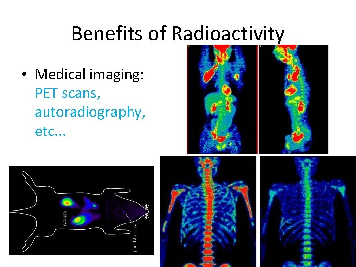 Benefits of Radioactivity • Medical imaging: PET scans, autoradiography, etc. . . Benefits of Radioactivity • Medical imaging: PET scans, autoradiography, etc. . .