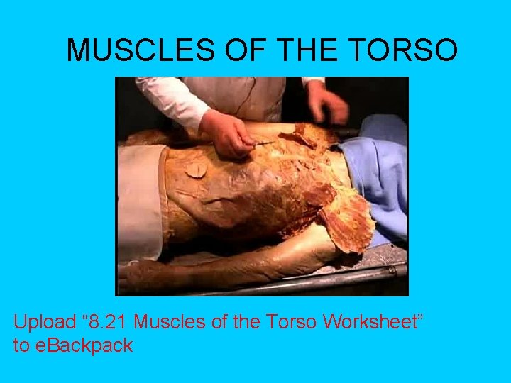 MUSCLES OF THE TORSO Upload “ 8. 21 Muscles of the Torso Worksheet” to