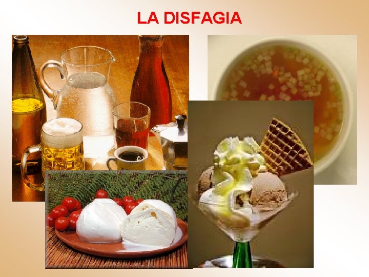 LA DISFAGIA 