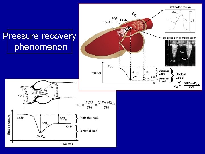 Pressure recovery phenomenon 