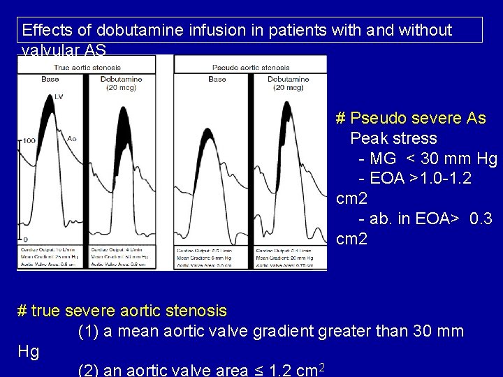 Effects of dobutamine infusion in patients with and without valvular AS # Pseudo severe