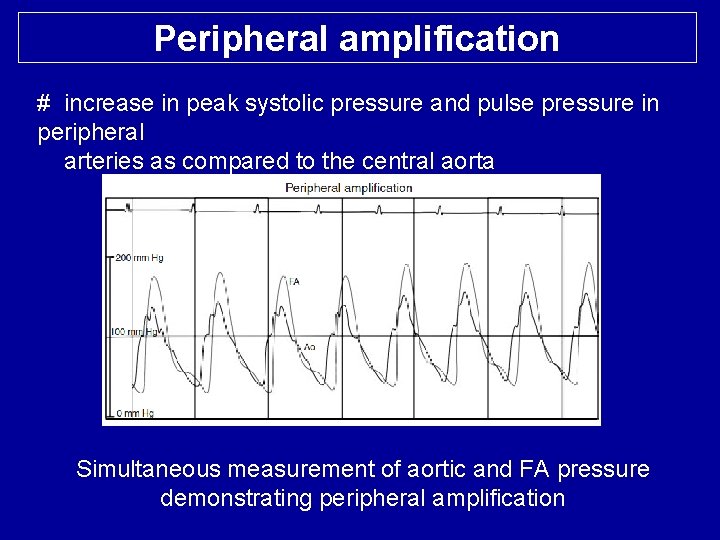 Peripheral amplification # increase in peak systolic pressure and pulse pressure in peripheral arteries