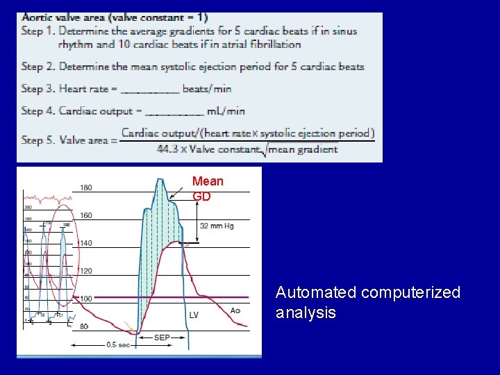 Mean GD Automated computerized analysis 