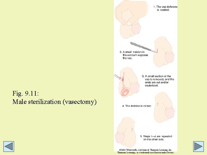 Fig. 9. 11: Male sterilization (vasectomy) © 2003 Wadsworth, a division of Thomson Learning, Fig. 9. 11: Male sterilization (vasectomy) © 2003 Wadsworth, a division of Thomson Learning,