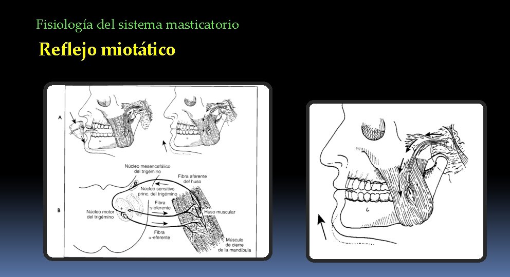 Fisiología del sistema masticatorio Reflejo miotático 