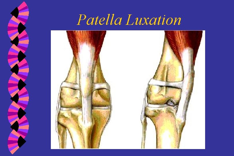Patella Luxation 